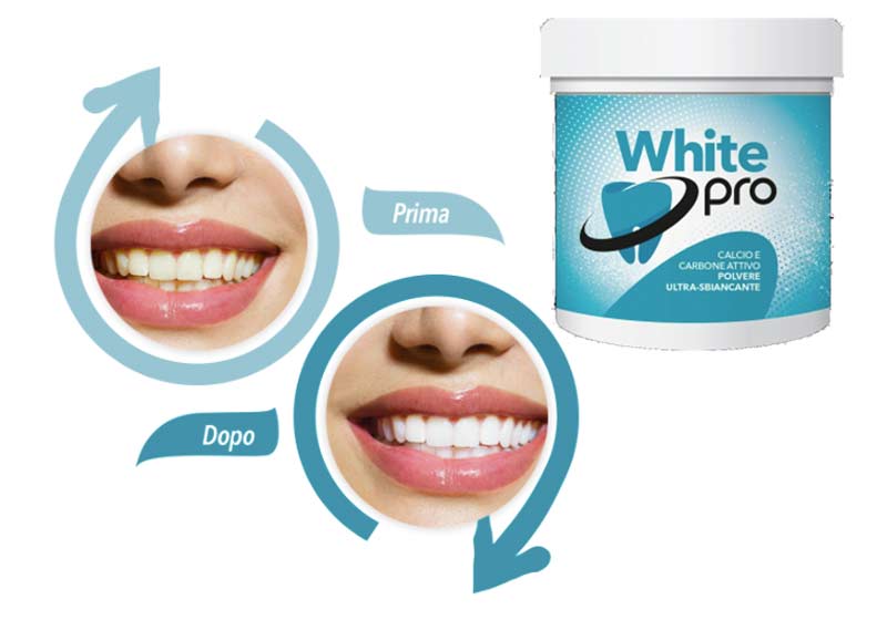 Opinioni su White Pro sbianca denti: Funziona davvero o è una truffa? Recensione